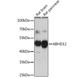 Western Blot - Anti-ABHD12 Antibody (A309202) - Antibodies.com