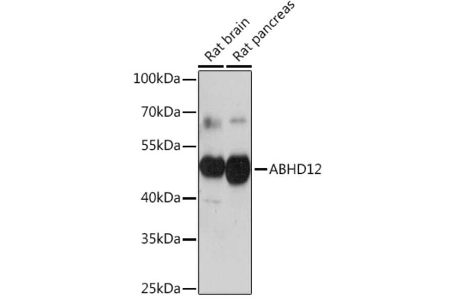 Western Blot - Anti-ABHD12 Antibody (A309202) - Antibodies.com