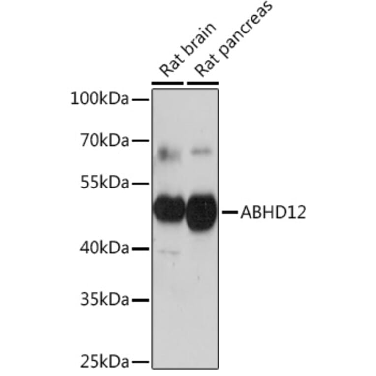 Western Blot - Anti-ABHD12 Antibody (A309202) - Antibodies.com