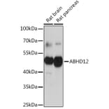 Western Blot - Anti-ABHD12 Antibody (A309202) - Antibodies.com
