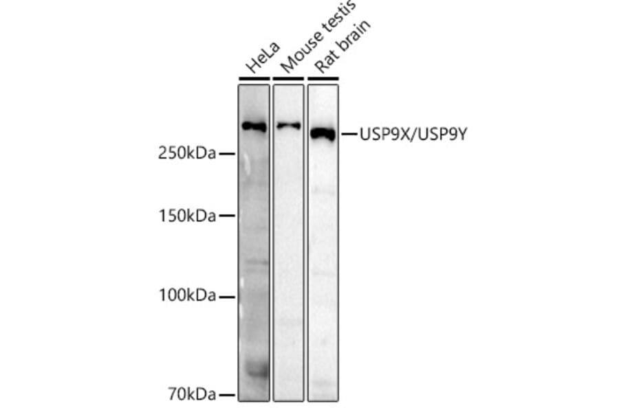 Western Blot - Anti-USP9Y Antibody (A309204) - Antibodies.com