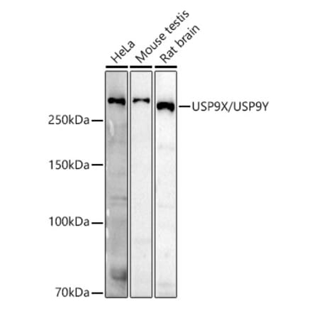 Western Blot - Anti-USP9Y Antibody (A309204) - Antibodies.com