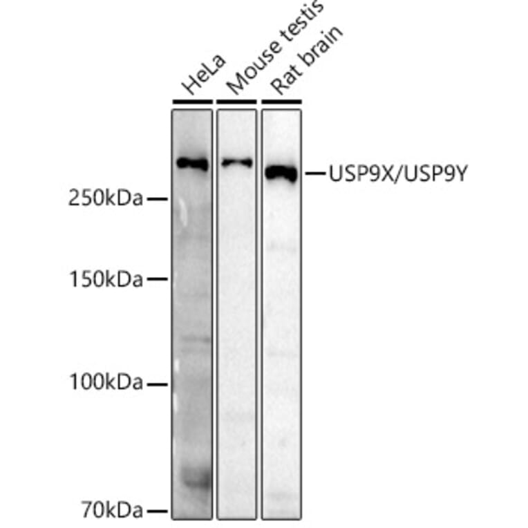 Western Blot - Anti-USP9Y Antibody (A309204) - Antibodies.com