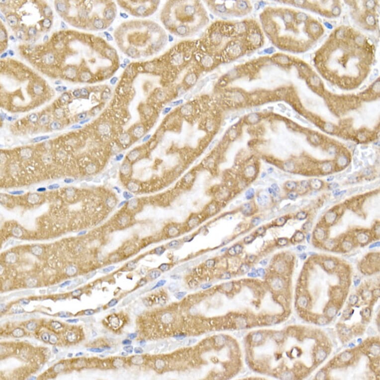 Immunohistochemistry - Anti-USP9Y Antibody (A309204) - Antibodies.com
