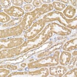 Immunohistochemistry - Anti-USP9Y Antibody (A309204) - Antibodies.com