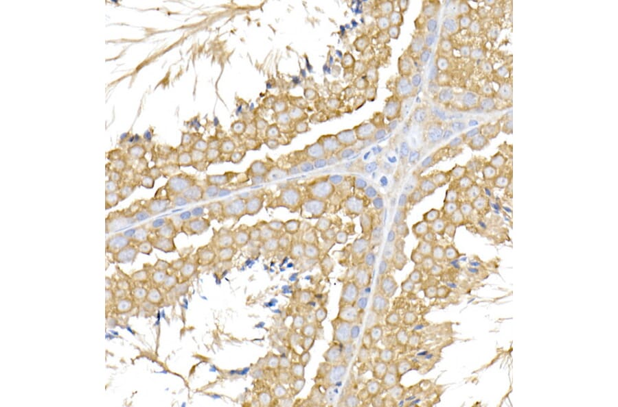 Immunohistochemistry - Anti-USP9Y Antibody (A309204) - Antibodies.com