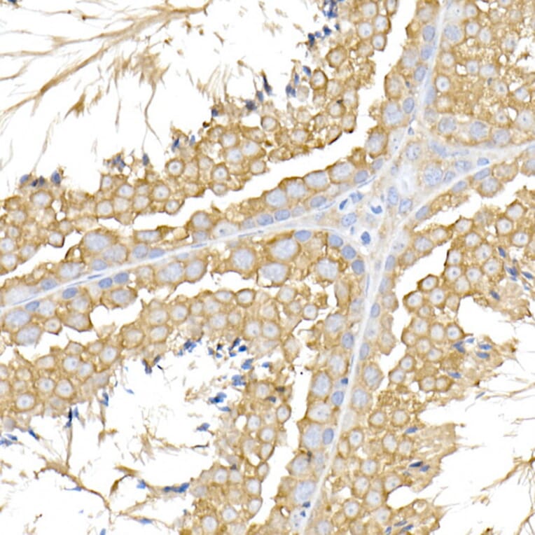 Immunohistochemistry - Anti-USP9Y Antibody (A309204) - Antibodies.com