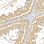Immunohistochemistry - Anti-USP9Y Antibody (A309204) - Antibodies.com