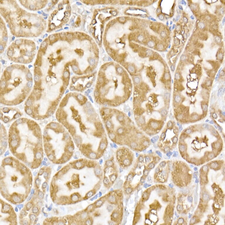 Immunohistochemistry - Anti-USP9Y Antibody (A309204) - Antibodies.com