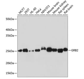 Western Blot - Anti-GRB2 Antibody [ARC0430] (A309206) - Antibodies.com