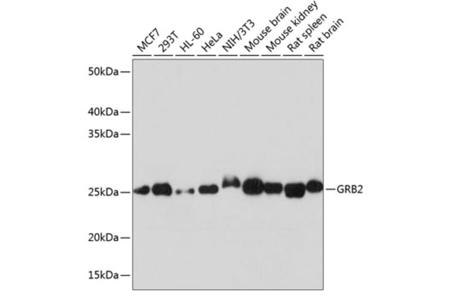 Western Blot - Anti-GRB2 Antibody [ARC0430] (A309206) - Antibodies.com