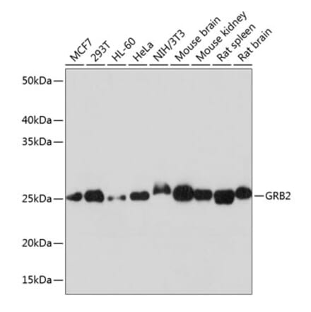 Western Blot - Anti-GRB2 Antibody [ARC0430] (A309206) - Antibodies.com
