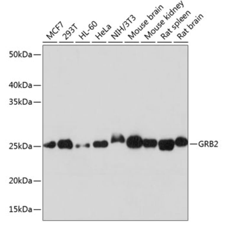 Western Blot - Anti-GRB2 Antibody [ARC0430] (A309206) - Antibodies.com