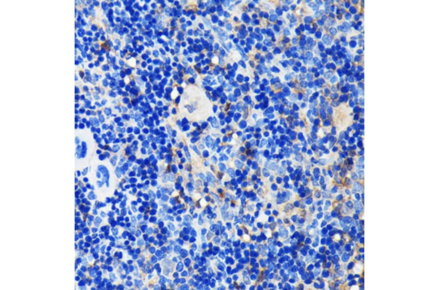 Immunohistochemistry - Anti-GRB2 Antibody [ARC0430] (A309206) - Antibodies.com