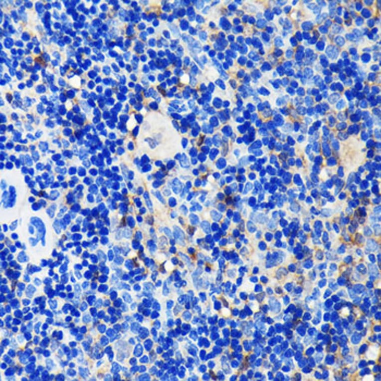 Immunohistochemistry - Anti-GRB2 Antibody [ARC0430] (A309206) - Antibodies.com