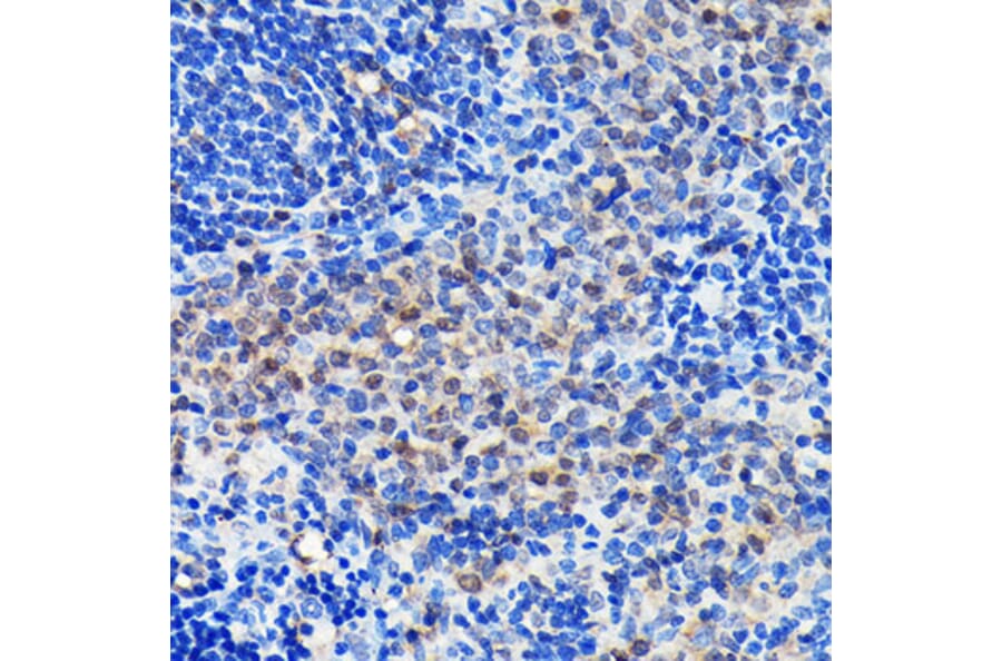 Immunohistochemistry - Anti-GRB2 Antibody [ARC0430] (A309206) - Antibodies.com
