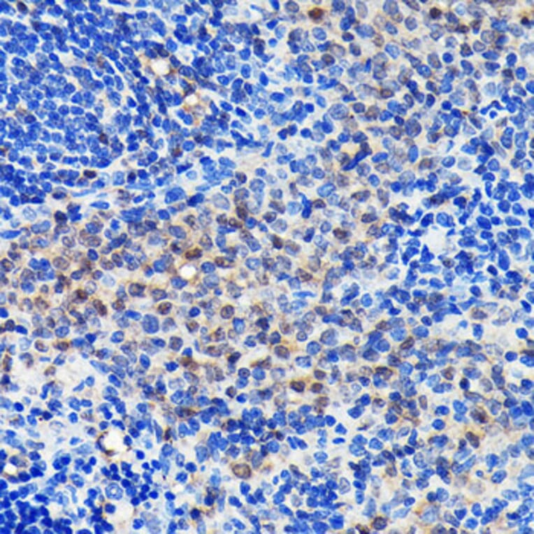 Immunohistochemistry - Anti-GRB2 Antibody [ARC0430] (A309206) - Antibodies.com