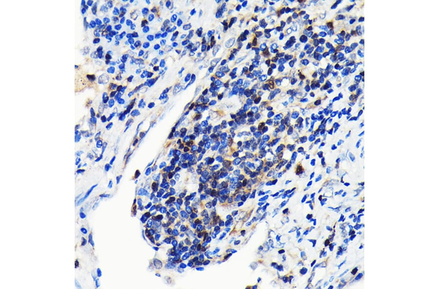 Immunohistochemistry - Anti-GRB2 Antibody [ARC0430] (A309206) - Antibodies.com