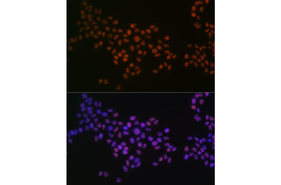 Immunofluorescence - Anti-GRB2 Antibody [ARC0430] (A309206) - Antibodies.com