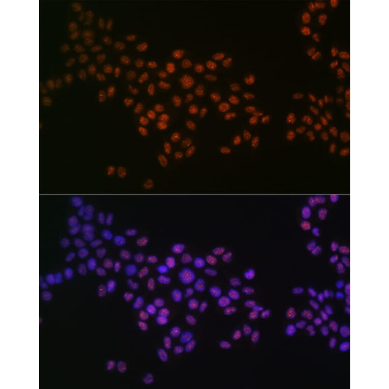 Immunofluorescence - Anti-GRB2 Antibody [ARC0430] (A309206) - Antibodies.com