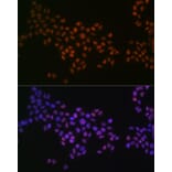 Immunofluorescence - Anti-GRB2 Antibody [ARC0430] (A309206) - Antibodies.com