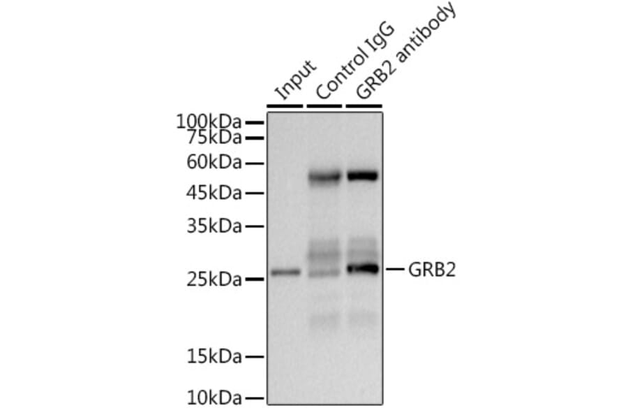 Western Blot - Anti-GRB2 Antibody [ARC0430] (A309206) - Antibodies.com