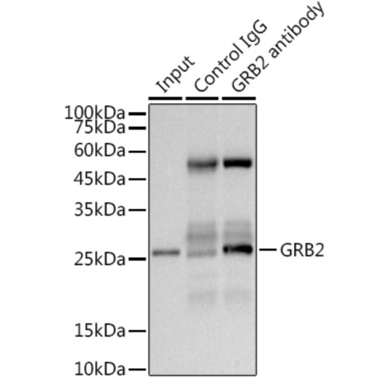 Western Blot - Anti-GRB2 Antibody [ARC0430] (A309206) - Antibodies.com