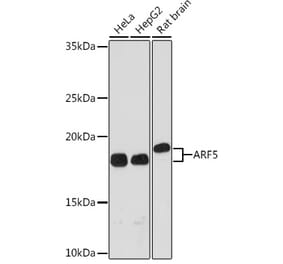 Western Blot - Anti-ARF5 Antibody [ARC1960] (A309207) - Antibodies.com