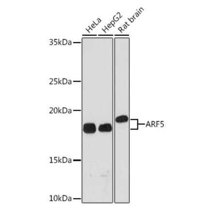 Western Blot - Anti-ARF5 Antibody [ARC1960] (A309207) - Antibodies.com