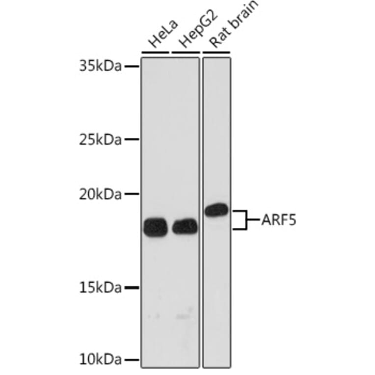 Western Blot - Anti-ARF5 Antibody [ARC1960] (A309207) - Antibodies.com