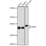 Western Blot - Anti-ARF5 Antibody [ARC1960] (A309207) - Antibodies.com