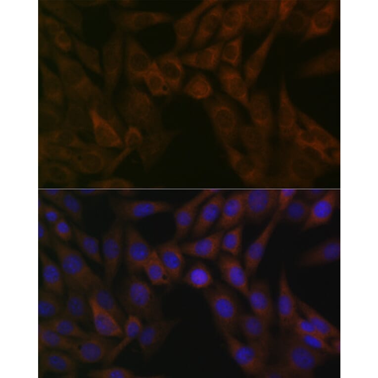 Immunofluorescence - Anti-ARF5 Antibody [ARC1960] (A309207) - Antibodies.com