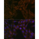 Immunofluorescence - Anti-ARF5 Antibody [ARC1960] (A309207) - Antibodies.com