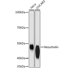 Western Blot - Anti-Mesothelin Antibody [ARC1464] (A309208) - Antibodies.com