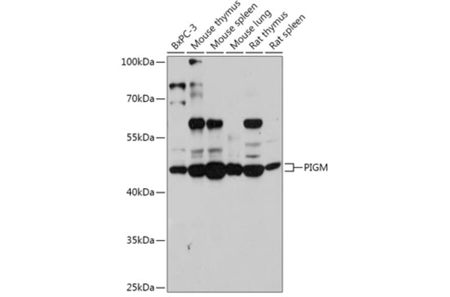 Western Blot - Anti-PIGM Antibody (A309211) - Antibodies.com