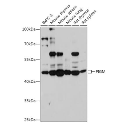 Western Blot - Anti-PIGM Antibody (A309211) - Antibodies.com
