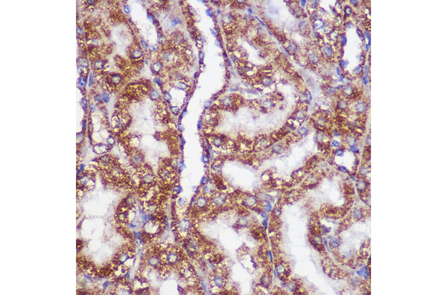Immunohistochemistry - Anti-PIGM Antibody (A309211) - Antibodies.com