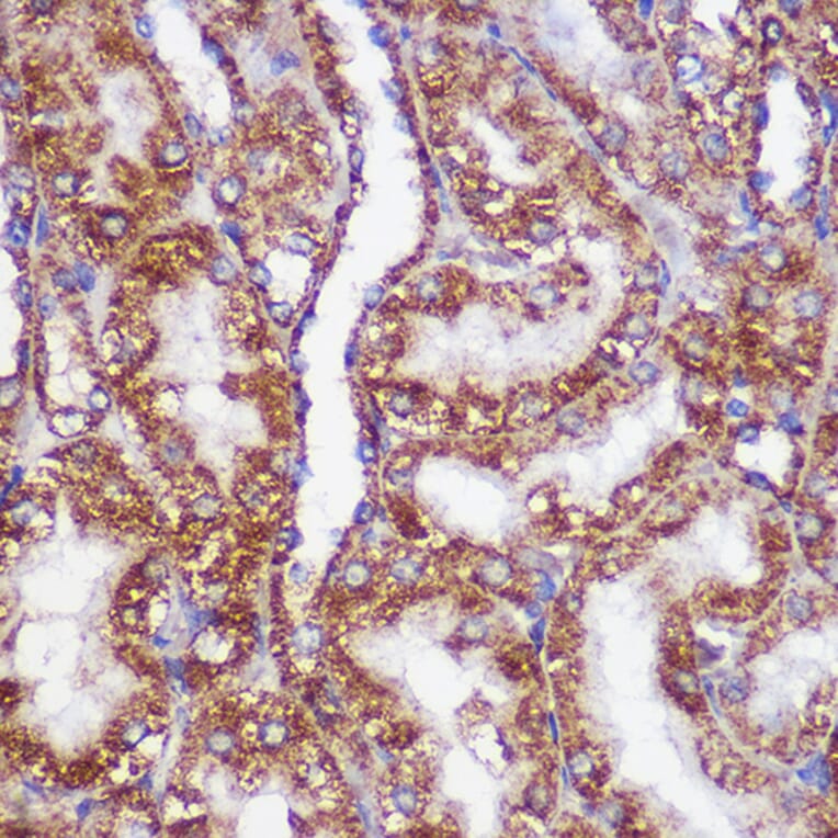 Immunohistochemistry - Anti-PIGM Antibody (A309211) - Antibodies.com