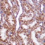 Immunohistochemistry - Anti-PIGM Antibody (A309211) - Antibodies.com