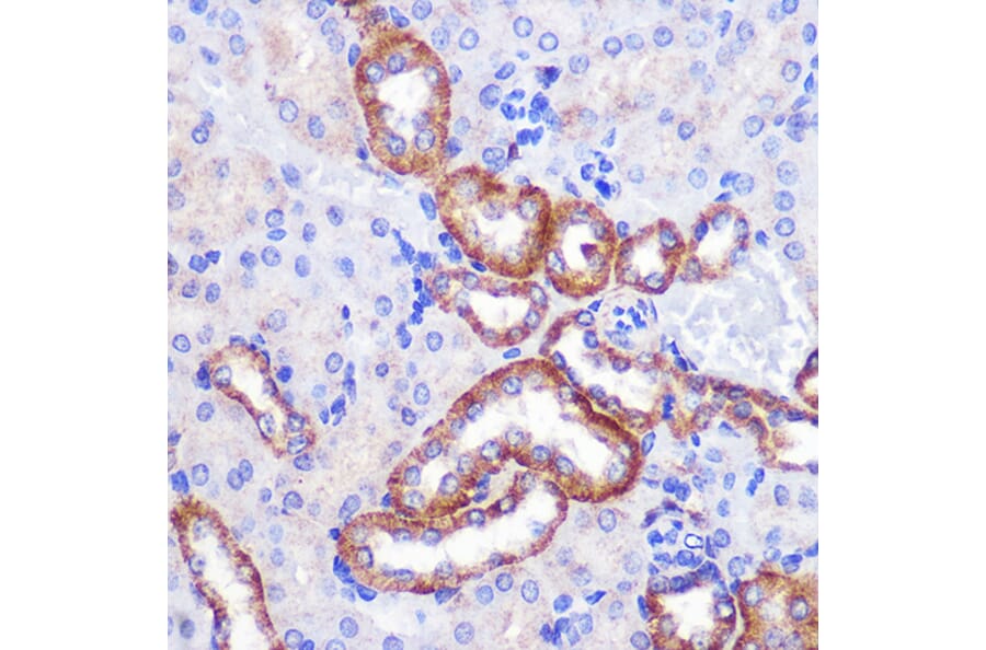 Immunohistochemistry - Anti-PIGM Antibody (A309211) - Antibodies.com
