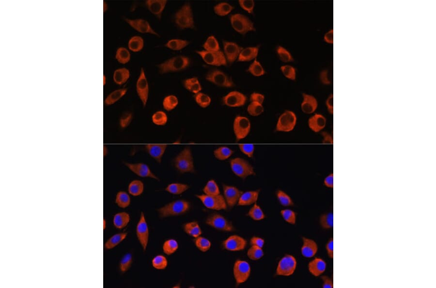 Immunofluorescence - Anti-PIGM Antibody (A309211) - Antibodies.com