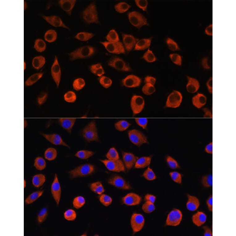 Immunofluorescence - Anti-PIGM Antibody (A309211) - Antibodies.com