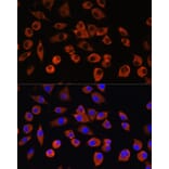 Immunofluorescence - Anti-PIGM Antibody (A309211) - Antibodies.com