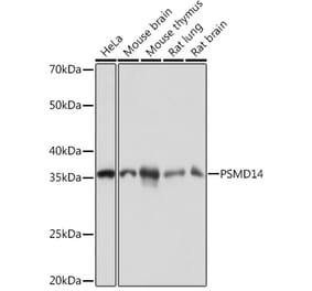 Western Blot - Anti-PSMD14 Antibody [ARC1655] (A309212) - Antibodies.com