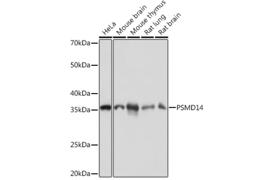 Western Blot - Anti-PSMD14 Antibody [ARC1655] (A309212) - Antibodies.com