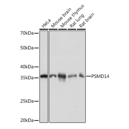 Western Blot - Anti-PSMD14 Antibody [ARC1655] (A309212) - Antibodies.com