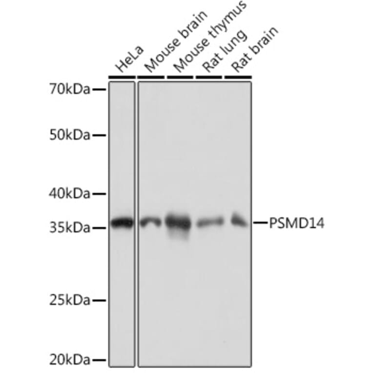 Western Blot - Anti-PSMD14 Antibody [ARC1655] (A309212) - Antibodies.com