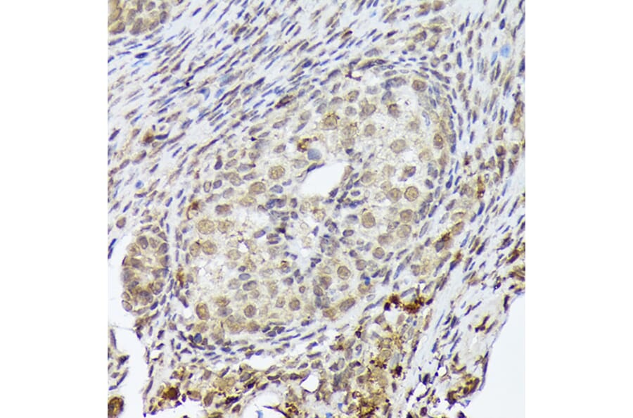 Immunohistochemistry - Anti-PSMD14 Antibody [ARC1655] (A309212) - Antibodies.com