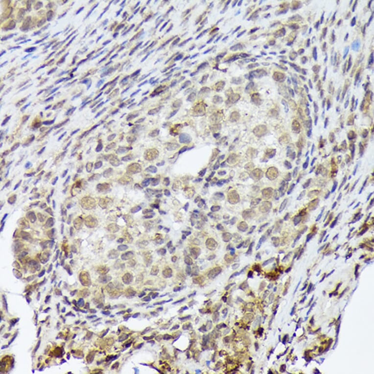 Immunohistochemistry - Anti-PSMD14 Antibody [ARC1655] (A309212) - Antibodies.com