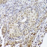 Immunohistochemistry - Anti-PSMD14 Antibody [ARC1655] (A309212) - Antibodies.com